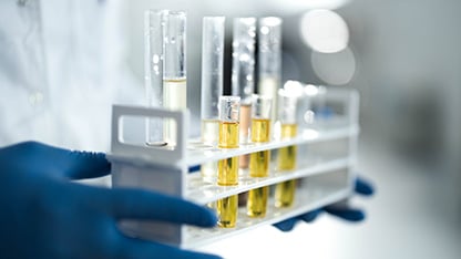 Scientist with test tubes